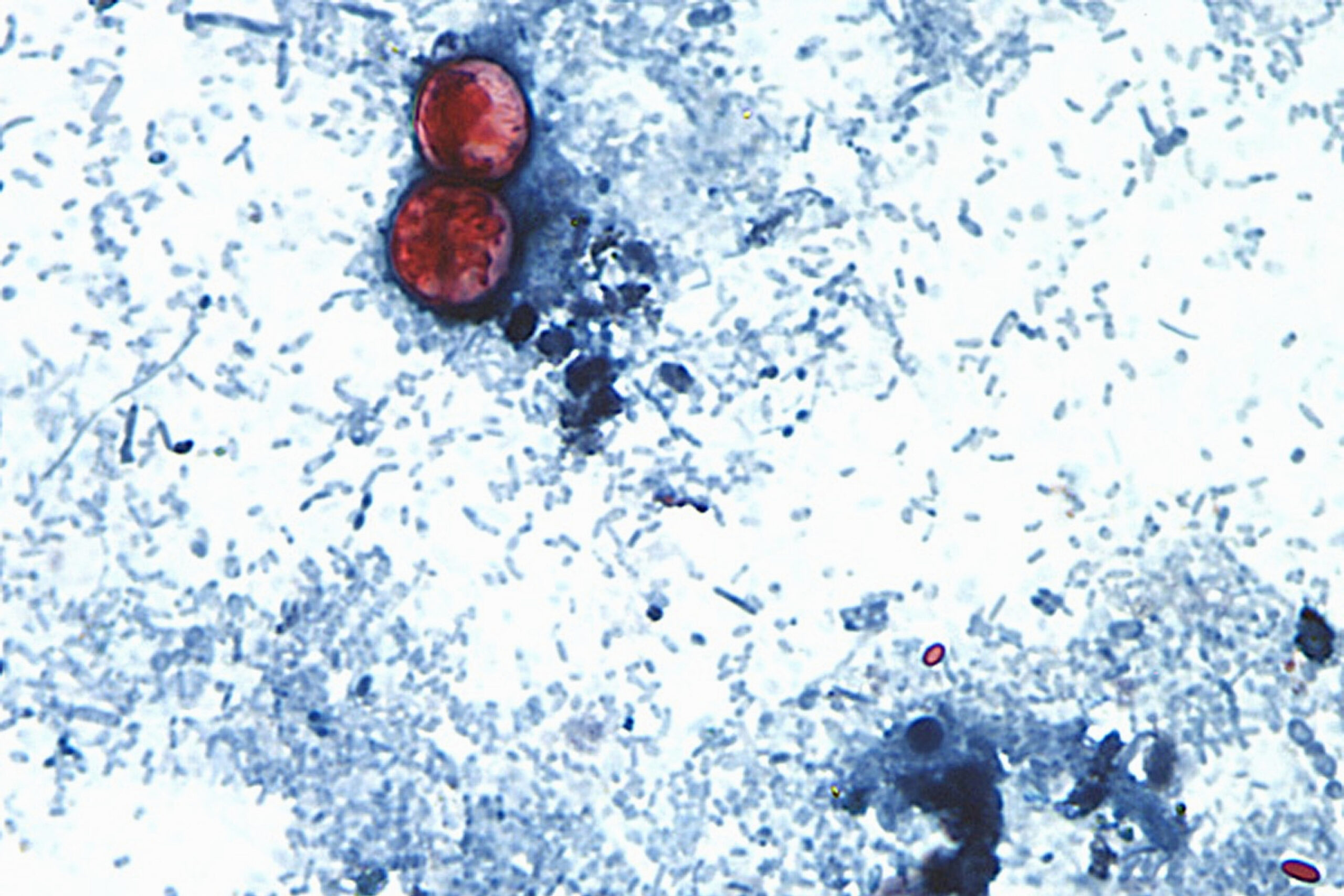 MCHD: Six local cyclosporiasis cases, no 'strong link' to Taco Bell